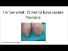 Psoriasis Home Remedies | How To Treat Psoriasis EFFECTIVELY!!