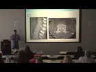 Northwest Indiana Back Specialist Explains CT Scan, CAT Scan, Spine Surgeon,