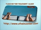 varicose vein treatment  marin