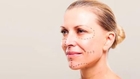 Study: Plastic Surgery Makes People Look Less Younger Than Expected