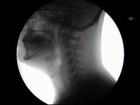 Yiyip İçerken X-Ray Cihazında Nasıl Gözükürüz